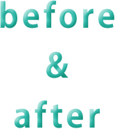 before&after